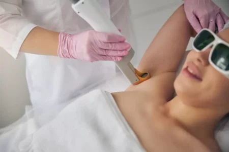 Laser Hair Removal