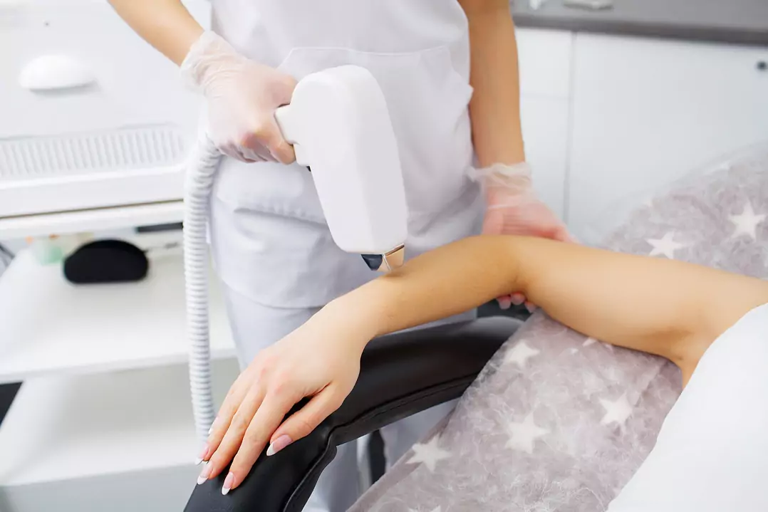 Laser Hair Treatment Toronto