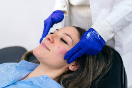 Rosacea Treatment toronto Rosacea Treatment Toronto