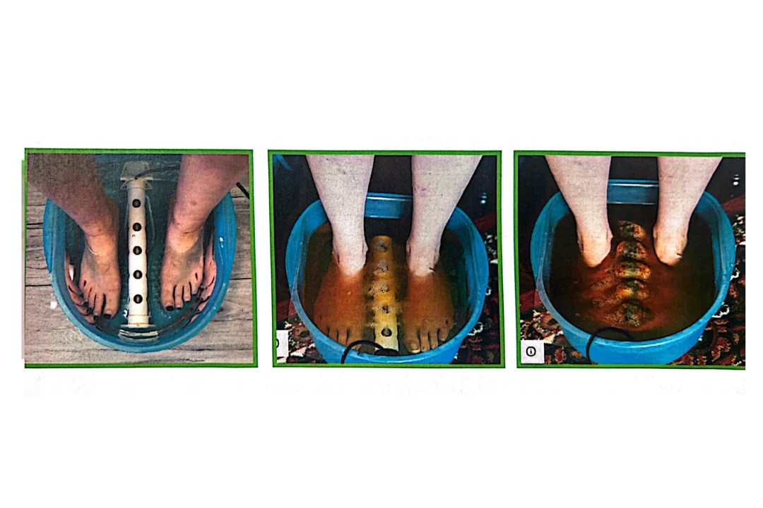 does ionic foot detox work