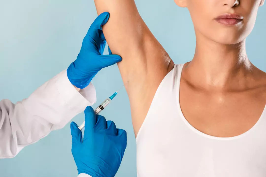 hidrosis treatment