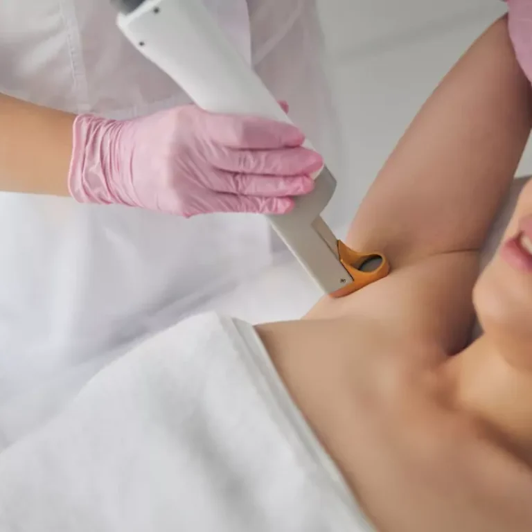 Laser Hair Removal