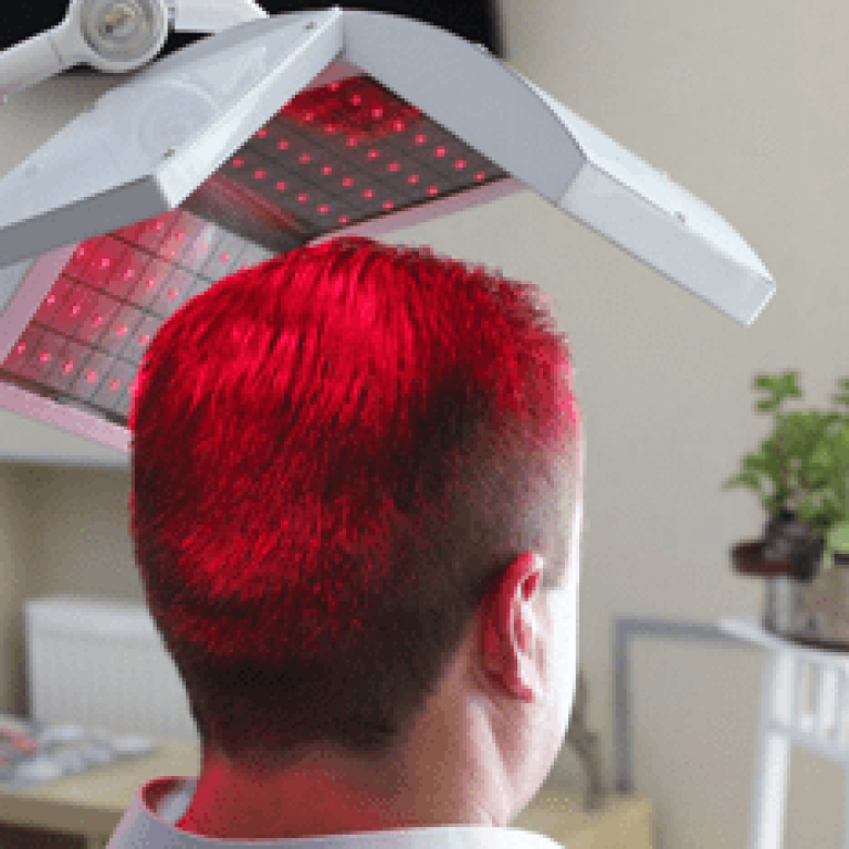 Laser Hair Treatment Toronto