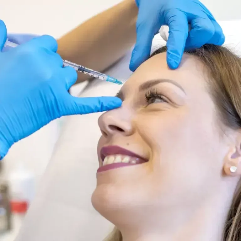 Botox for Migraine
