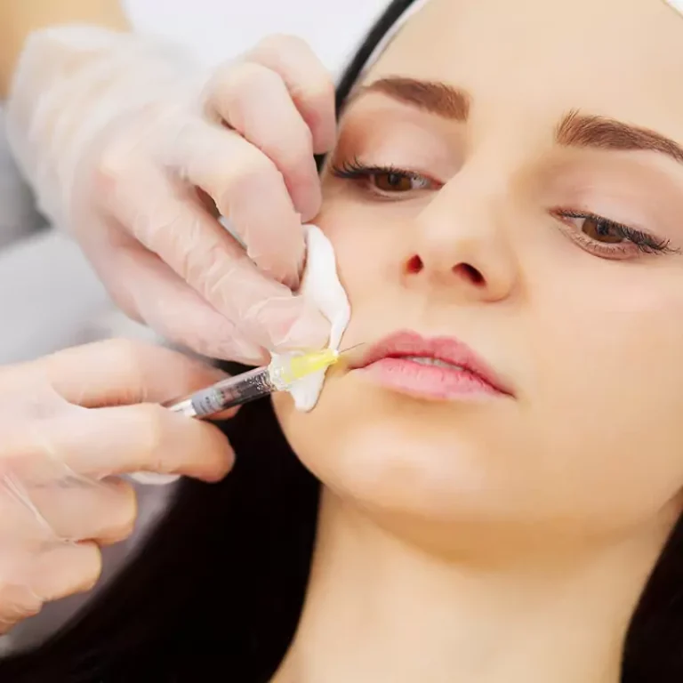 Dermal Fillers Toronto