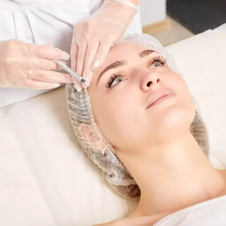 mesotherapy for face